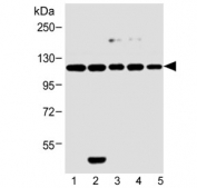 Western blot testing of human 1) MCF-7, 2) HeLa, 3) SH-SY5Y, 4) 293T and 5) rat PC-12 cell lysate with Insulin receptor-related antibody. Expected molecular weight: ~80 kDa, 144 kDa.