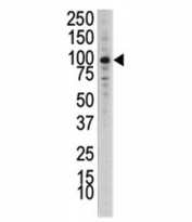Western blot analysis of DDR1 antibody in human placental lysate. Predicted molecular weight: 100~125KD.