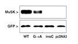 Western blot testing of COS cells after transfection with MUSK mutated and GFP (control) with MUSK antibody. Expression was normal in wild-type (WT), diminished in the GA mutant and no expression with the insC mutant or the pcDNA3 vector alone.
