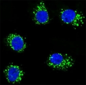 Confocal immunofluorescent analysis of MUSK antibody with MDA-MB231 cells followed by Alexa Fluor 488-conjugated goat anti-rabbit lgG (green). DAPI was used as a nuclear counterstain (blue).