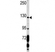 Western blot analysis of PDGFRA antibody and human K562 lysate. Expected molecular weight: 120-195 kDa.