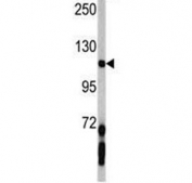 Western blot analysis of PDGFRA antibody and mouse lung tissue lysate. Expected molecular weight: 120-195 kDa.