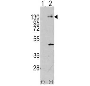 Western blot analysis of PDGFR antibody and 293 cell lysate (2 ug/lane) either nontransfected (Lane 1) or transiently transfected with the PDGFRA gene (2). Predicted molecular weight: 120-195 kDa.~