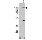 Western blot analysis of PDGFR antibody and 293 cell lysate (2 ug/lane) either nontransfected (Lane 1) or transiently transfected with the PDGFRA gene (2). Predicted molecular weight: 120-195 kDa.