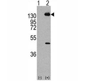 Western blot analysis of PDGFRA antibody and293 cell lysate (2 ug/lane) either nontransfected (Lane 1) or transiently transfected with the human gene (2). Predicted molecular weight: 120-195 kDa.~