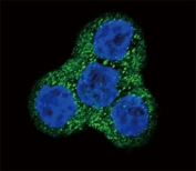 Confocal immunofluorescent analysis of PDGFR beta antibody with WiDr cells followed by Alexa Fluor 488-conjugated goat anti-rabbit lgG (green). DAPI was used as a nuclear counterstain (blue).