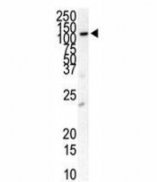 Western blot analysis of anti-PDGFR beta antibody