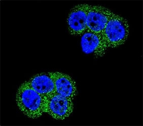 Confocal immunofluorescent analysis of PDGFRB antibody with WiDr cells followed by Alexa Fluor 488-conjugated goat anti-rabbit lgG (green). DAPI was used as a nuclear counterstain (blue).~
