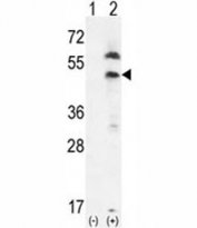 Western blot analysis of PDGFRL and 293 cell lysate either nontransfected (Lane 1) or transiently transfected (2) with the PDGFRL gene.