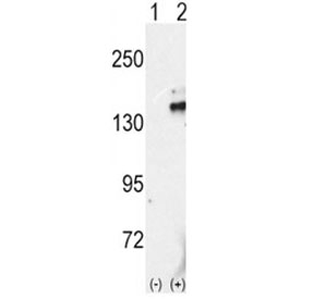 Western blot analysis of RET antibody and 293 cell lysate either nontransfected (Lane 1) or transiently transfected with the RET gene (2).~