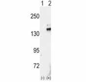 Western blot analysis of RET antibody and 293 cell lysate either nontransfected (Lane 1) or transiently transfected with the RET gene (2).