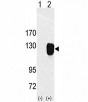 Western blot analysis of ROR1 antibody and 293 cell lysate (2 ug/lane) either nontransfected (Lane 1) or transiently transfected with the ROR1 gene (2). Predicted molecular weight of ROR1 isoforms: 105 kDa and 130 kDa.