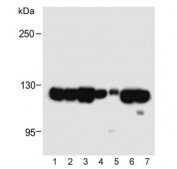 Western blot testing of human samples 1) K562 cell line, 2) MDA-MB-231, 3) PANC-1, 4) NCI-H226, 5) fetal lung and mouse samples 6) NIH3T3 and 7) heart lysate with ROR1 antibody at 1:1000. Predicted molecular weight of ROR1 isoforms: 105 kDa and 130 kDa.