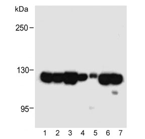 Western blot testing of human samples 1) K562 cell line, 2) MDA-MB-231, 3) PANC-1, 4) NCI-H226, 5) fetal lung and mouse samples 6) NIH3T3 and 7) heart lysate with ROR1 antibody at 1:1000. Predicted molecular weight of ROR1 isoforms: 105 kDa and 130 kDa.