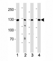 Western blot testing of human samples 1) K562 and 2) lung lysate and mouse samples 3) kidney and 4) heart lysate with ROR1 antibody at 1:1000. Predicted molecular weight of ROR1 isoforms: 105 kDa and 130 kDa.