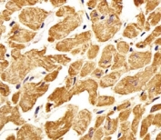 Immunohistochemical analysis of paraffin-embedded human heart section using ROR1 antibody. Ab was diluted at 1:25 dilution.