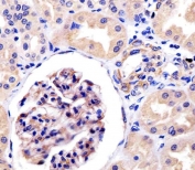 IHC testing of FFPE human kidney tissue with ROR1 antibody at 1:25 dilution. HIER: steamed antigen retrieval with pH6 citrate buffer.