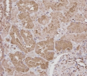 IHC testing of FFPE human kidney tissue with ROR1 antibody at 1:100 dilution. HIER: steamed antigen retrieval with pH9 EDTA buffer.