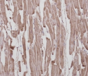 IHC testing of FFPE human heart tissue with ROR1 antibody at 1:100 dilution. HIER: steamed antigen retrieval with pH9 EDTA buffer.