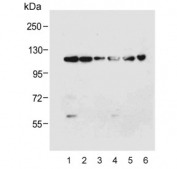 Western blot testing of human lysate samples 1) K562, 2) MDA-MB-231, 3) NCI-H226, 4) A549 and mouse samples 5) NIH3T3 and 6) kidney lysate with ROR1 antibody at 1:4000. Predicted molecular weight of ROR1 isoforms: 105 kDa and 130 kDa.