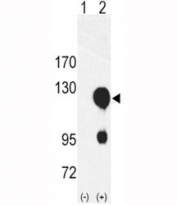 Western blot analysis of ROR2 antibody and 293 cell lysate either nontransfected (Lane 1) or transiently transfected with the ROR2 gene (2).