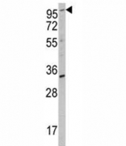 Western blot analysis of ROR2 antibody and K562 lysate.