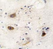 IHC analysis of FFPE human brain tissue stained with ROR2 antibody