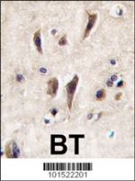IHC analysis of FFPE human brain tissue stained with TIE1 antibody