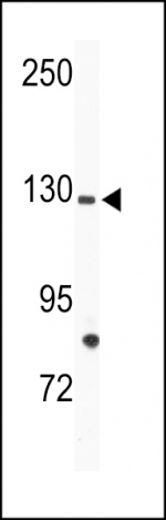 Western blot analysis of TIE1 antibody and mouse bladder tissue lysate