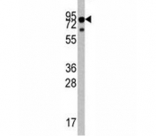 Western blot analysis of TrkA antibody and mouse liver tissue lysate. Observed molecular weight: 85~140 kDa depending on glycosylation level.