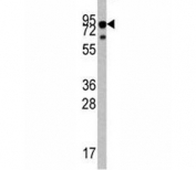 Western blot analysis of TrkA antibody and mouse liver tissue lysate. Observed molecular weight: 85~140 kDa depending on glycosylation level.