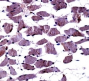 TrkA antibody immunohistochemistry analysis in formalin fixed and paraffin embedded human skeletal muscle.