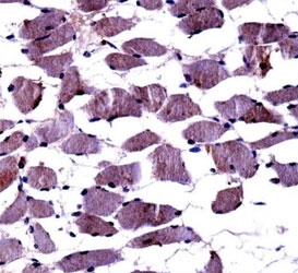 TrkA antibody immunohistochemistry analysis in formalin fixed and paraffin embedded human skeletal muscle.