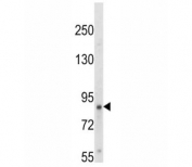 Western blot analysis of TrkA antibody and HepG2 lysate. Observed molecular weight: 85~140 kDa depending on glycosylation level.