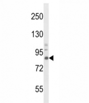 Western blot analysis of TrkA antibody and mouse brain tissue lysate. Observed molecular weight: 85~140 kDa depending on glycosylation level.