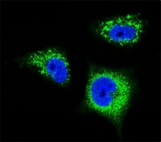 Confocal immunofluorescent analysis of TrkA antibody with MDA-MB231 cells followed by Alexa Fluor 488-conjugated goat anti-rabbit lgG (green). DAPI was used as a nuclear counterstain (blue).