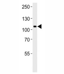 TrkC antibody western blot analysis in U87-MG lysate. Observed molecular weight 95~145 kDa depending on glycosylation level.