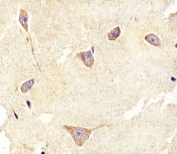 IHC analysis of FFPE human brain section using TrkC antibody; Ab was diluted at 1:100.