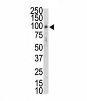 Western blot analysis of DDR2 antibody and HL-60 lysate. Predicted molecular weight: 97-116 kDa.