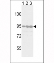 Western blot analysis of DDR2 antibody in Jurkat (lane 1), 293 (2) and HeLa (3) lysate. Predicted molecular weight: 97-116 kDa.