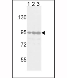 Western blot analysis of DDR2 antibody in Jurkat (lane 1), 293 (2) and HeLa (3) lysate. Predicted molecular weight: 97-116 kDa.