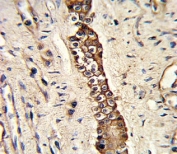 IHC analysis of FFPE human normal lung with DDR2 antibody