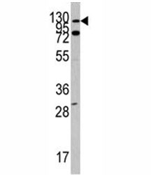 Western blot analysis of ABL1 antibody and Y79 lysate. Predicted molecular weight ~120 kDa.