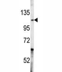 Western blot analysis of c-Abl antibody and A2058 lysate. Predicted molecular weight ~120 kDa.