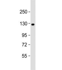 Western blot testing of human brain lysate with ACK1 antibody at 1:1000. Predicted molecular weight ~114 kDa.~