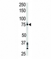 BTK antibody used in western blot to detect BTK in Ramos cell lysate