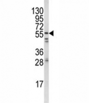 Western blot analysis of FYN antibody and HeLa lysate. Predicted molecular weight: ~59 kDa.