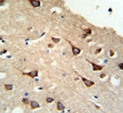 IHC analysis of FFPE human brain tissue stained with FYN antibody