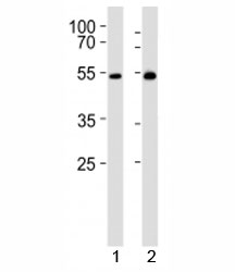 Western blot analysis of lysate from 1) mouse thymus and 2) rat thymus tissue lysate using LCK antibody at 1:1000. Predicted molecular weight ~58 kDa.