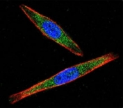 Confocal immunofluorescent analysis of LCK antibody with A2058 cells followed by Alexa Fluor 488-conjugated goat anti-rabbit lgG (green). Actin filaments have been labeled with Alexa Fluor 555 Phalloidin (red). DAPI was used as a nuclear counterstain (blue).